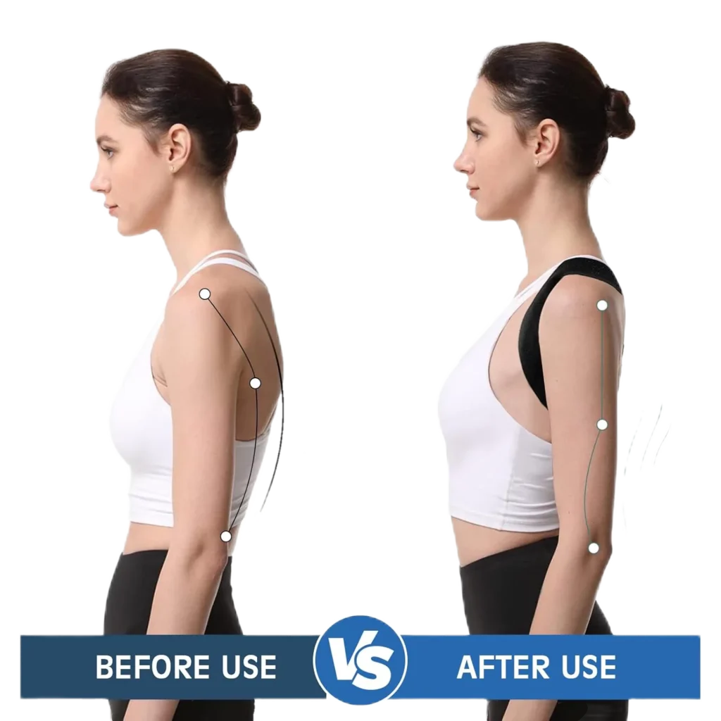 Before and after posture correction comparison showing a woman’s improved shoulder alignment and straighter back using an adjustable upper back brace; effective posture corrector for women and men, spine support straightener for neck, shoulder, back, and lumbar pain relief, comfortable and breathable design for daily wear by AI Artz.
